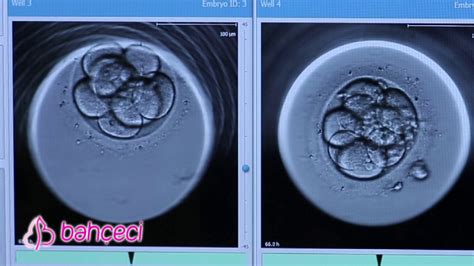 embriyo rahime tutunurken belirtiler